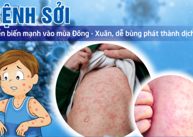 Dịch sởi ở trường học